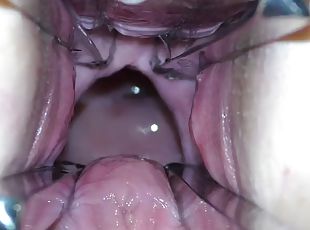 Mistresss cunt is opened with a hole dilator so that you can examine her cervix