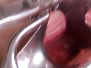 shows the uterus in close-up through a speculum
